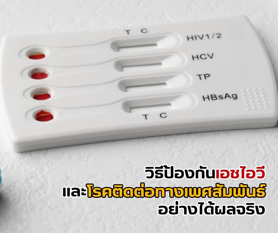 วิธีป้องกันเอชไอวี และโรคติดต่อทางเพศสัมพันธ์อย่างได้ผลจริง