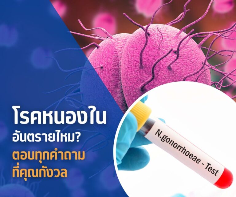 โรคหนองในอันตรายไหม? ตอบทุกคำถามที่คุณกังวล