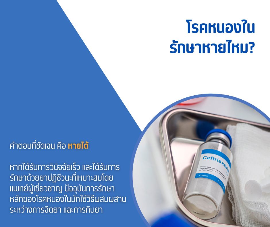 โรคหนองใน รักษาหายไหม