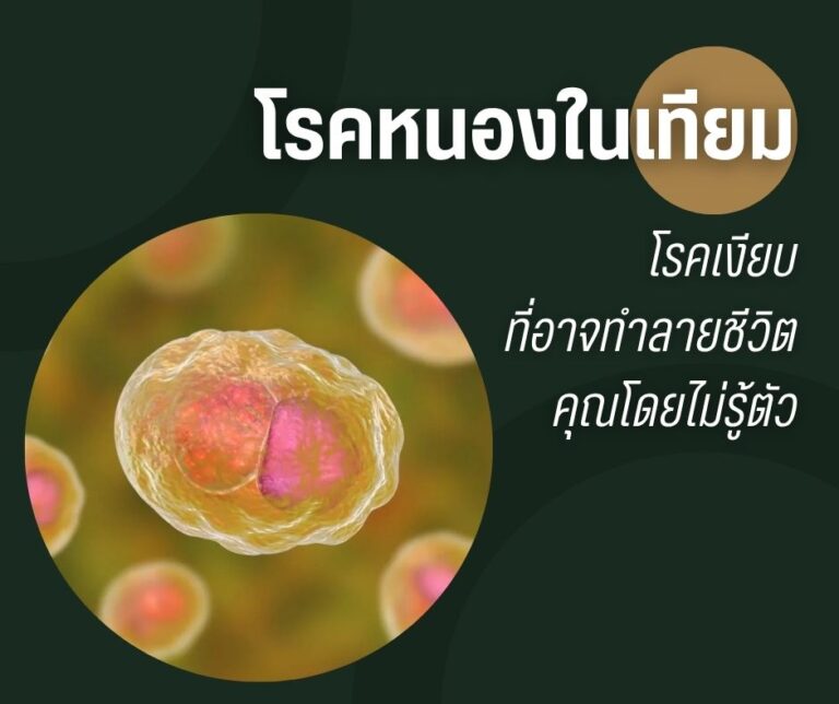 โรคหนองในเทียม โรคเงียบที่อาจทำลายชีวิตคุณโดยไม่รู้ตัว