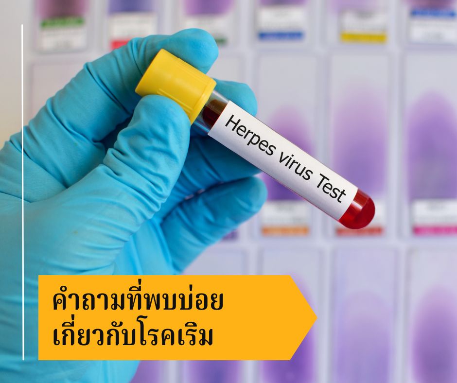 คำถามที่พบบ่อยเกี่ยวกับโรคเริม