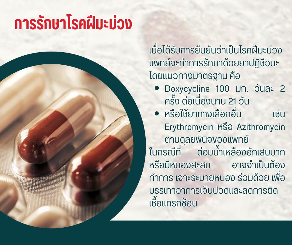 การรักษาโรคฝีมะม่วง