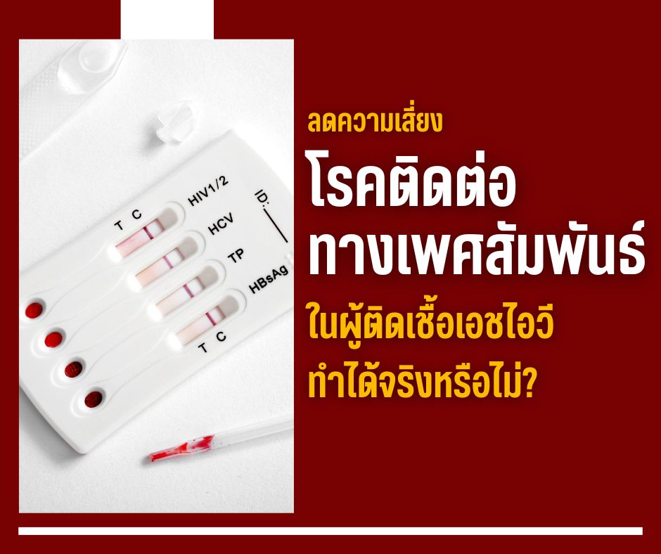 ลดความเสี่ยงโรคติดต่อทางเพศสัมพันธ์ในผู้ติดเชื้อเอชไอวี ทำได้จริงหรือไม่?
