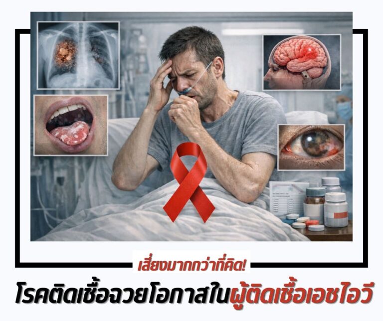 เสี่ยงมากกว่าที่คิด! โรคติดเชื้อฉวยโอกาสในผู้ติดเชื้อเอชไอวี