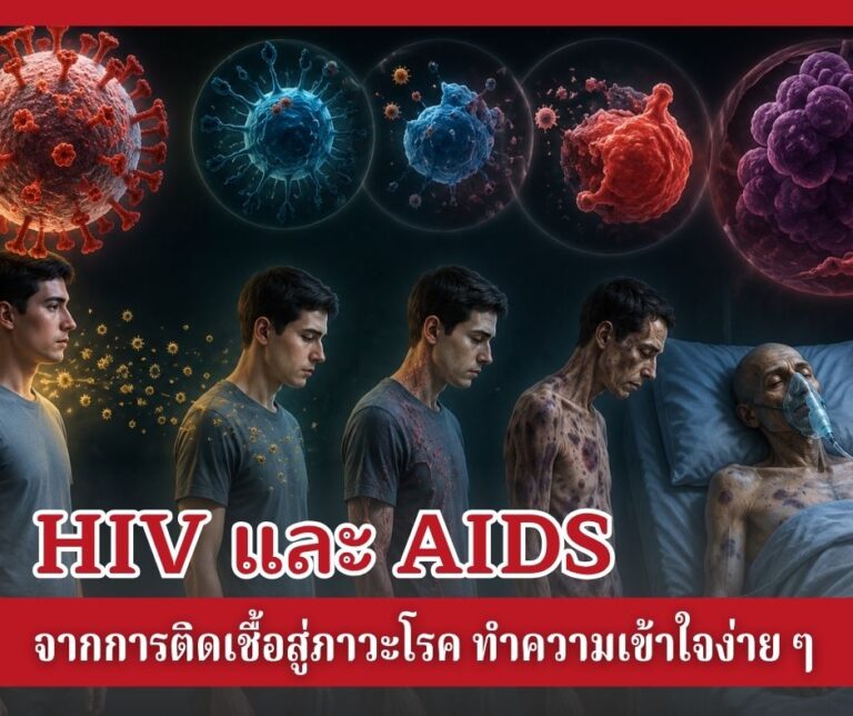 HIV และ AIDS จากการติดเชื้อสู่ภาวะโรค ทำความเข้าใจง่าย ๆ